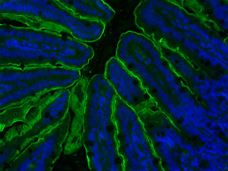 Kohli-FAQ1-figure2 Figure 2 - Apical Sodium Bile acid Transporter (ASBT) staining of the terminal ileum sections with ASBT antibody (green fluorescence). Stained area was significantly larger in VSG compared to Sham-operated mice.